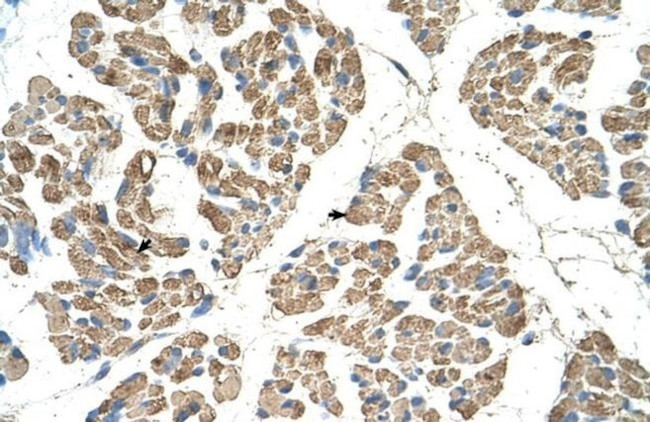 SLC22A7 Antibody in Immunohistochemistry (Paraffin) (IHC (P))