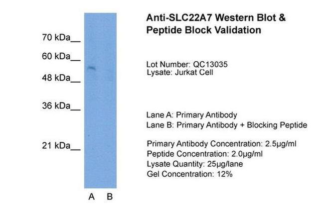 SLC22A7 Antibody in Western Blot (WB)