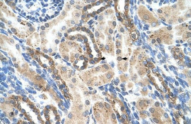 PSG1 Antibody in Immunohistochemistry (Paraffin) (IHC (P))