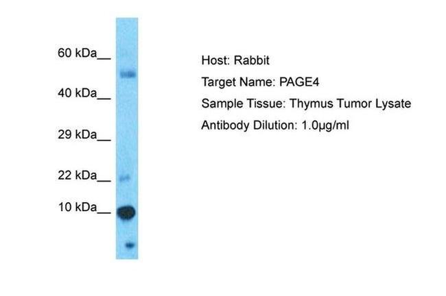 PAGE4 Antibody in Western Blot (WB)