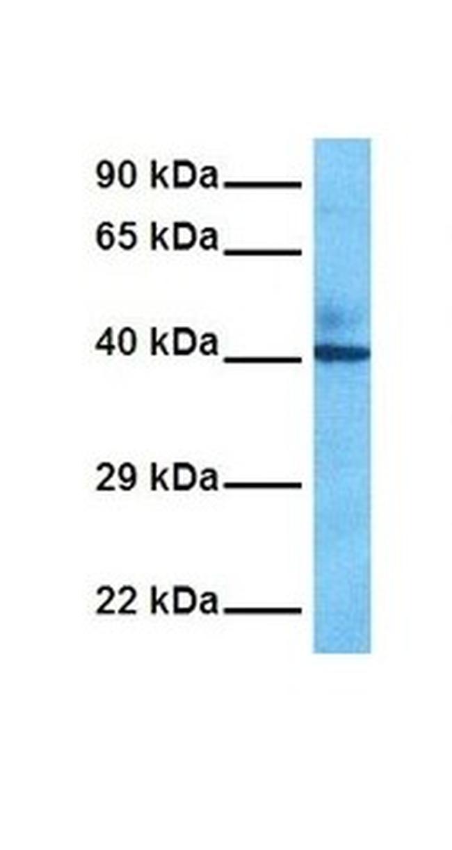 FADS1 Antibody in Western Blot (WB)