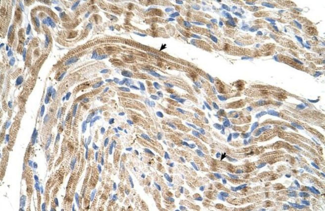 FADS1 Antibody in Immunohistochemistry (IHC)