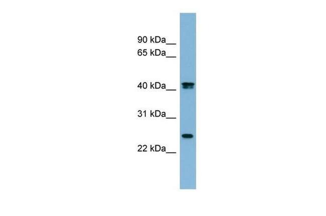 Fetuin B Antibody in Western Blot (WB)