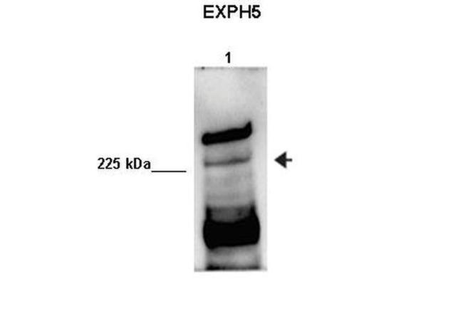 EXPH5 Antibody in Western Blot (WB)