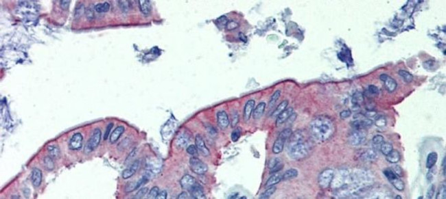 CGI58 Antibody in Immunohistochemistry (IHC)