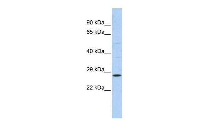 RAB38 Antibody in Western Blot (WB)