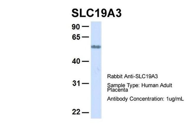 SLC19A3 Antibody in Western Blot (WB)