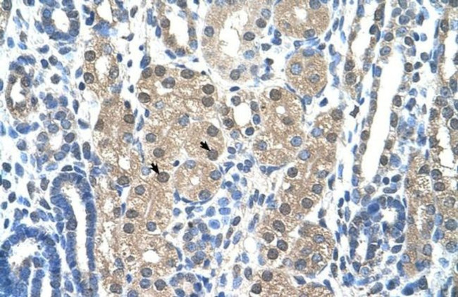 Granzyme H Antibody in Immunohistochemistry (IHC)