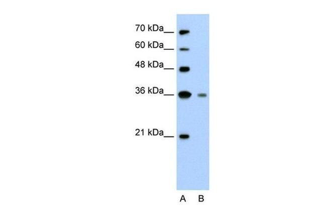 Granzyme H Antibody in Western Blot (WB)