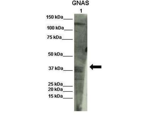 GNAS Antibody in Western Blot (WB)