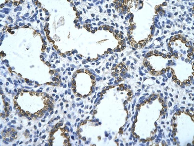 GNAS Antibody in Immunohistochemistry (Paraffin) (IHC (P))