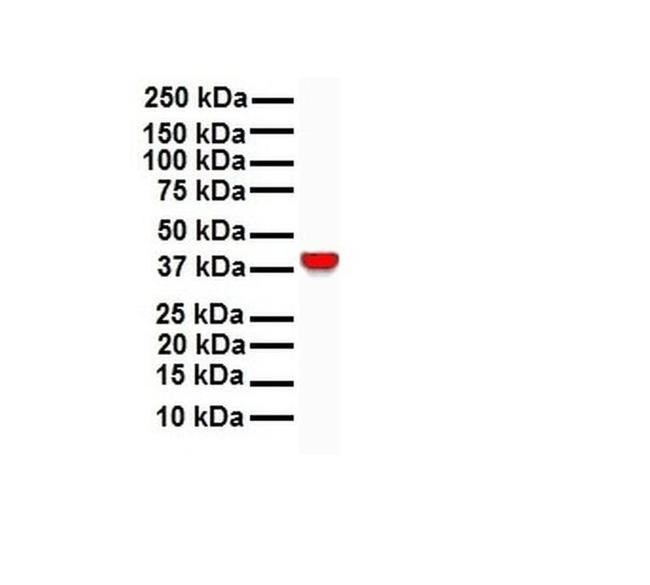 GNAS Antibody in Western Blot (WB)