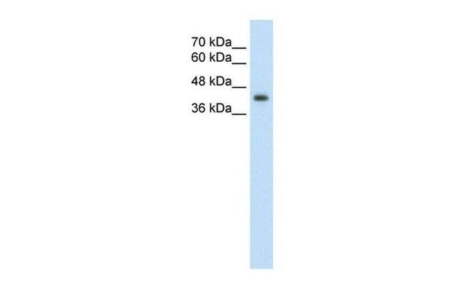 GNAS Antibody in Western Blot (WB)