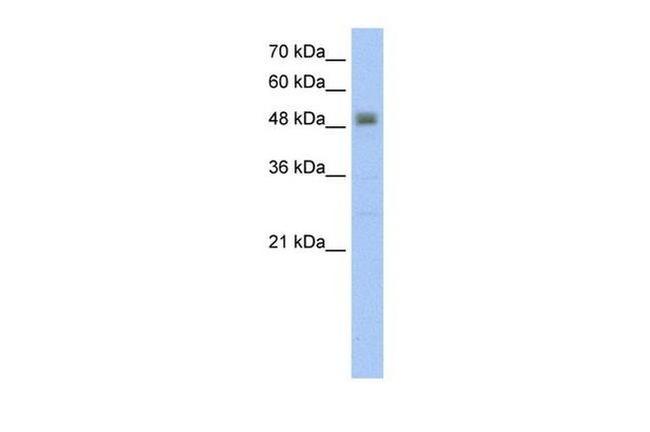 Viperin Antibody in Western Blot (WB)