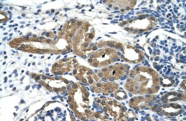 HDAC9 Antibody in Immunohistochemistry (Paraffin) (IHC (P))