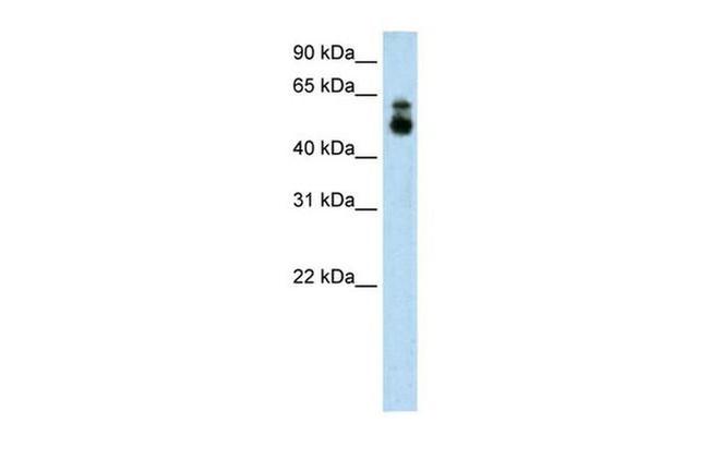 HDAC9 Antibody in Western Blot (WB)