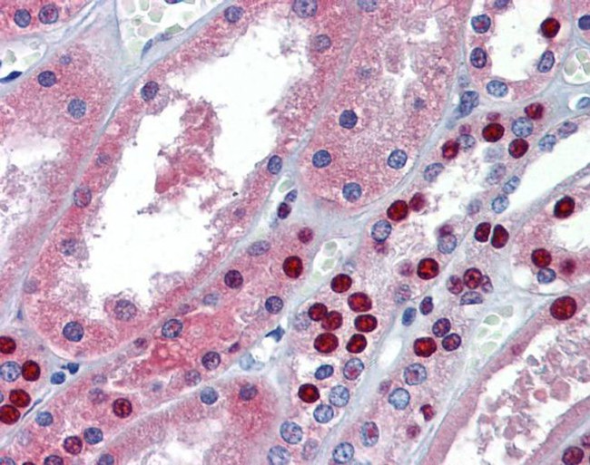 MUPP1 Antibody in Immunohistochemistry (IHC)