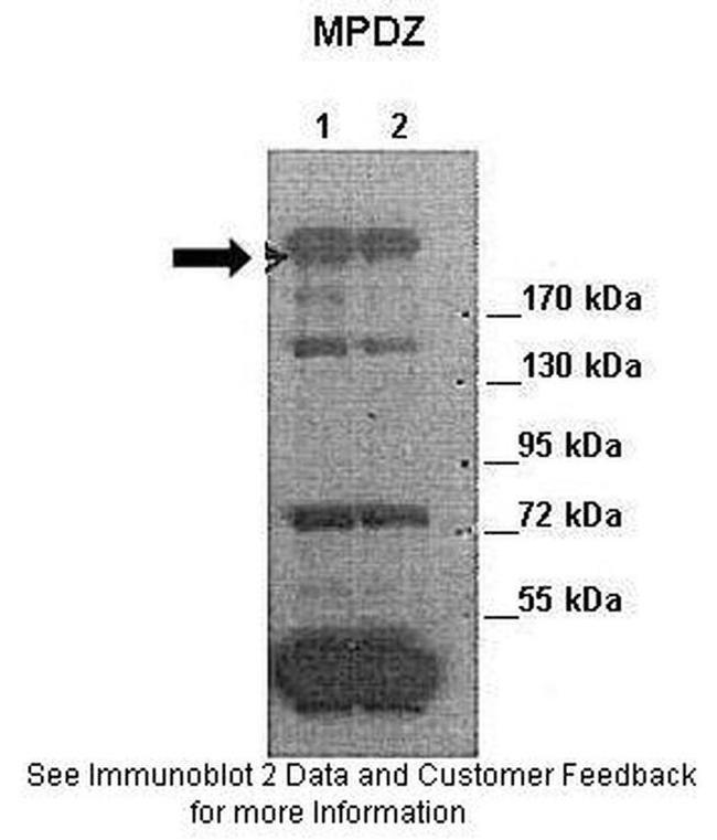 MUPP1 Antibody in Western Blot (WB)