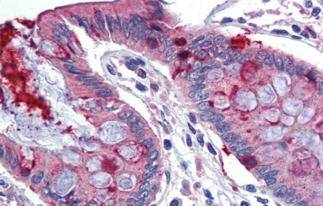 LIN7C Antibody in Immunohistochemistry (IHC)