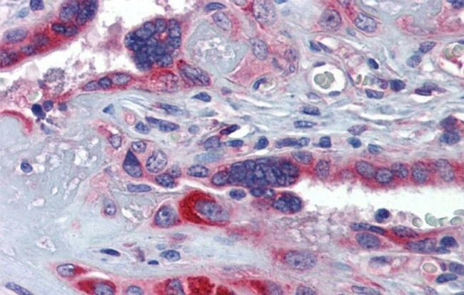 GTPBP10 Antibody in Immunohistochemistry (IHC)