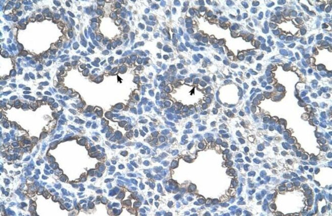 UBE2D2 Antibody in Immunohistochemistry (IHC)