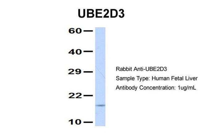 UBE2D3 Antibody in Western Blot (WB)