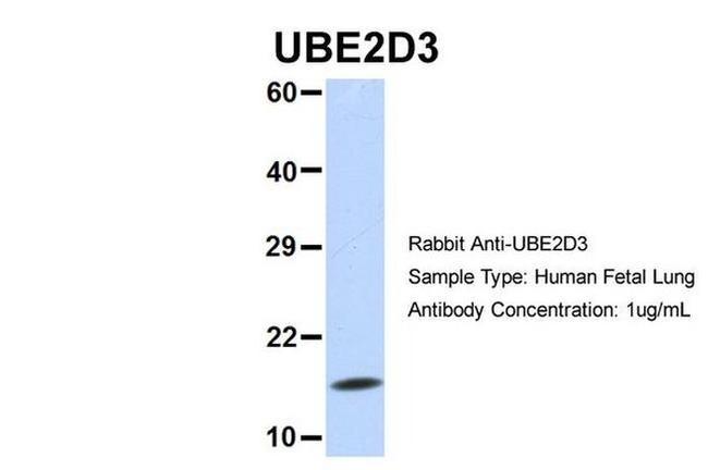 UBE2D3 Antibody in Western Blot (WB)