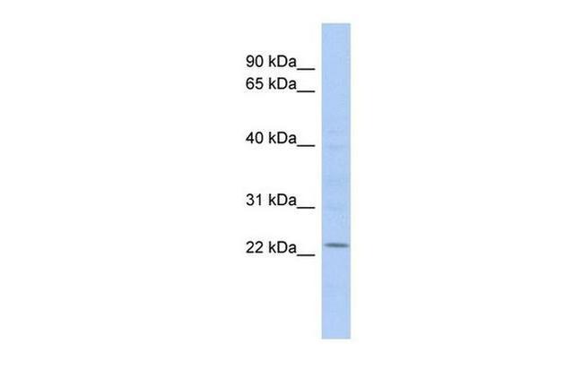 UBE2E1 Antibody in Western Blot (WB)