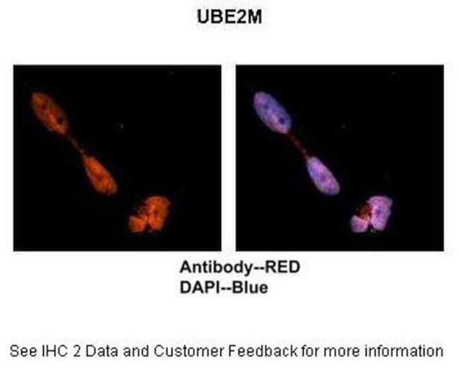 UBE2M Antibody in Immunohistochemistry (IHC)