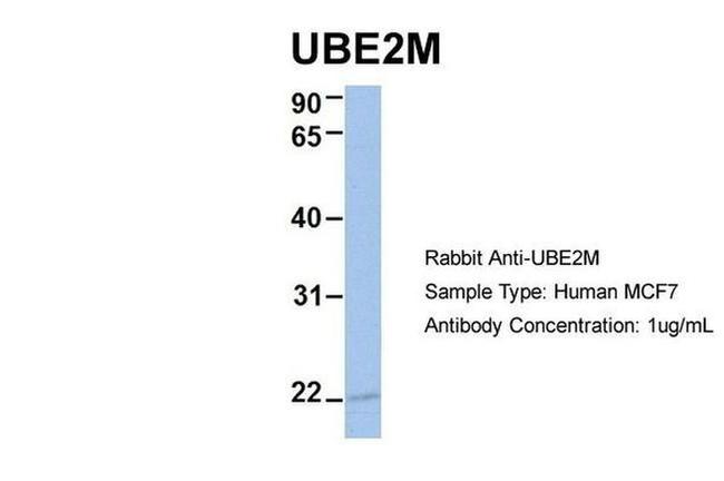 UBE2M Antibody in Western Blot (WB)