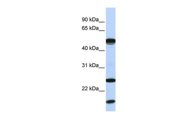 UBE2L6 Antibody in Western Blot (WB)