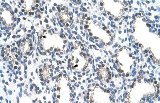 ALY Antibody in Immunohistochemistry (IHC)