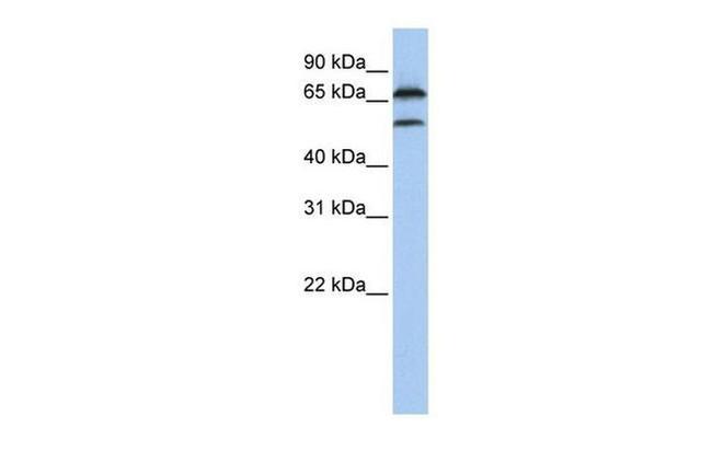 FBXO7 Antibody in Western Blot (WB)