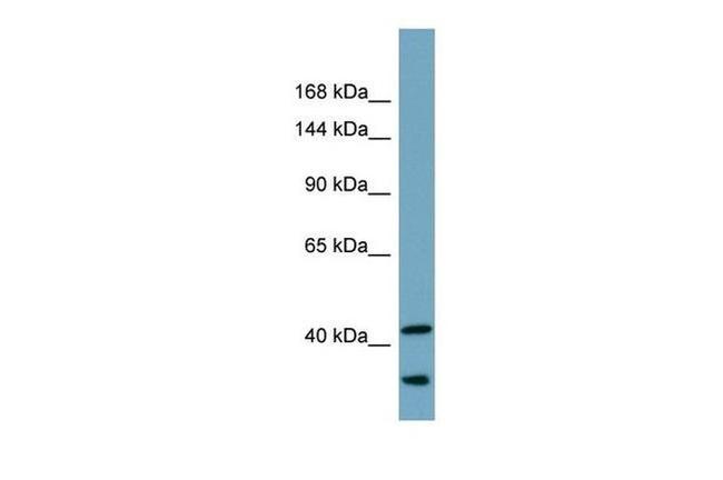 UBR2 Antibody in Western Blot (WB)