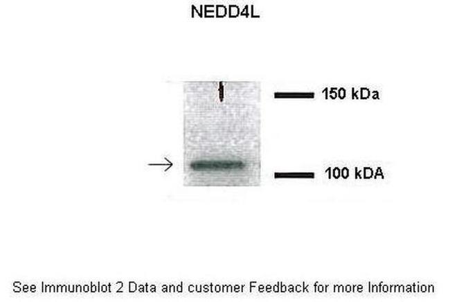 NEDD4L Antibody in Western Blot (WB)