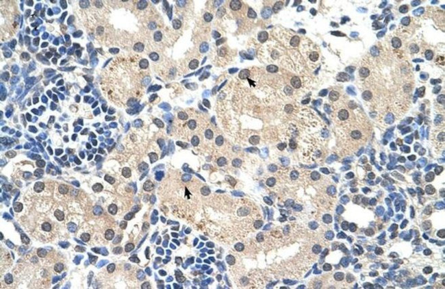 C14orf130 Antibody in Immunohistochemistry (IHC)