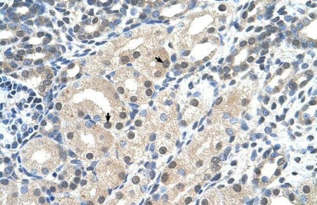 C14orf130 Antibody in Immunohistochemistry (IHC)