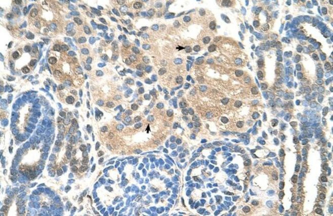 UBE2E2 Antibody in Immunohistochemistry (IHC)