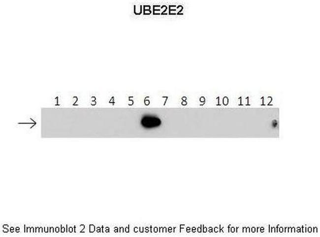 UBE2E2 Antibody in Western Blot (WB)