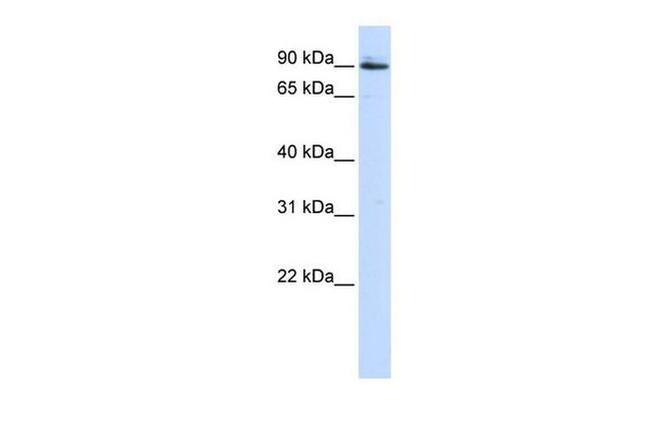 PCSK5 Antibody in Western Blot (WB)