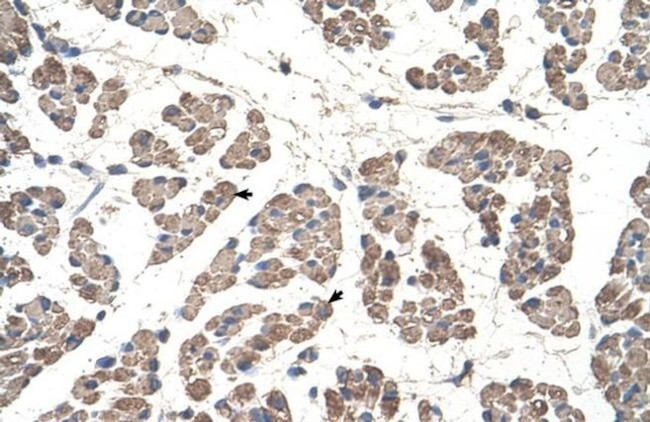 GCDH Antibody in Immunohistochemistry (IHC)