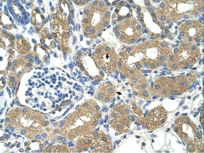 ADH4 Antibody in Immunohistochemistry (IHC)