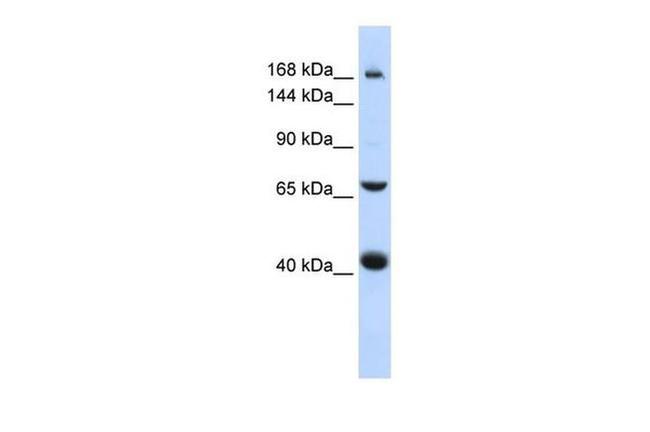 ABCC9 Antibody in Western Blot (WB)