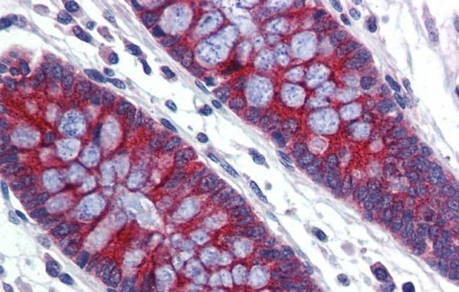 ABCA5 Antibody in Immunohistochemistry (IHC)