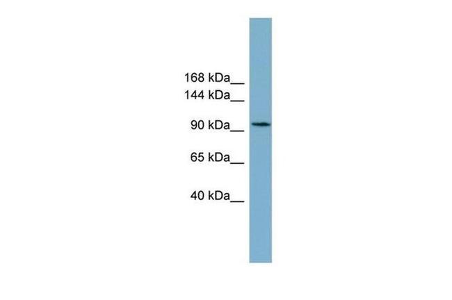 SLC12A3 Antibody in Western Blot (WB)