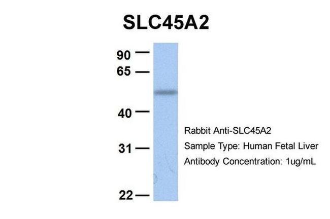 SLC45A2 Antibody in Western Blot (WB)