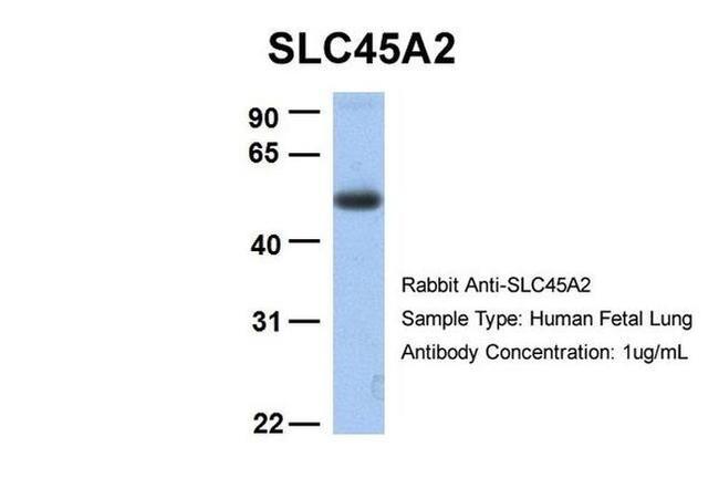 SLC45A2 Antibody in Western Blot (WB)