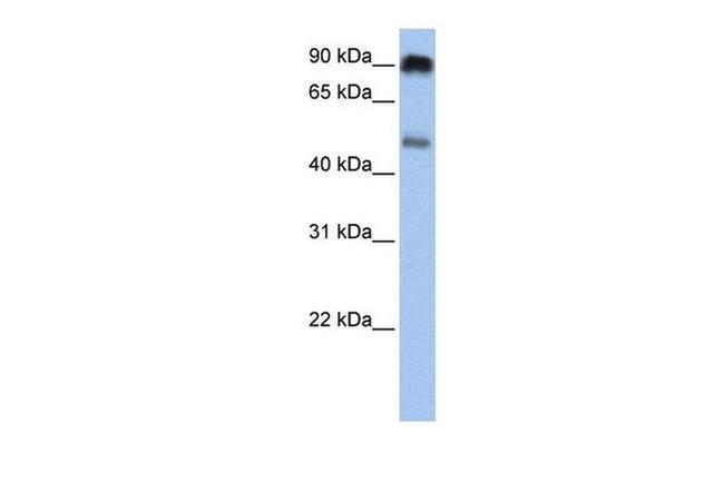 SLC45A2 Antibody in Western Blot (WB)