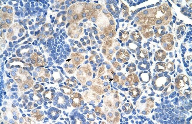 SLC38A1 Antibody in Immunohistochemistry (IHC)