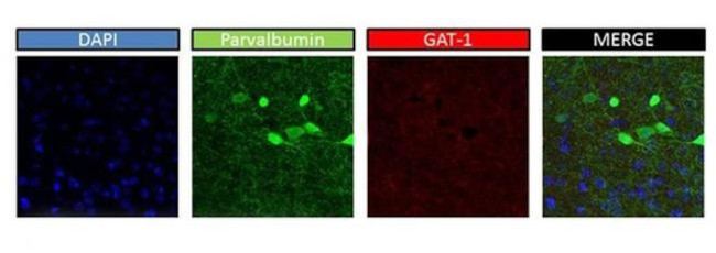 SLC6A1 Antibody in Immunohistochemistry (IHC)